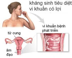 Bệnh nấm âm đạo là như thế nào?