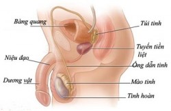 Nguyên nhân viêm đường tiết niệu